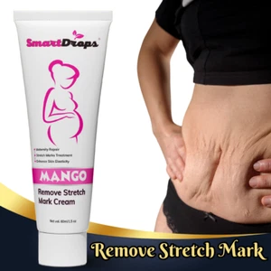 Stretch Remove Mark Cream Maternity Repair Stretch Marks, Acne, Surgery 60ml - Picture 1 of 5