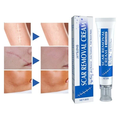 30g SCAR REMOVAL CREAM Skin Repair Scar Remover Acne Treatment Stretch Fade W1X0 - Image 1 of 4
