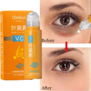 Anti Dark Circle Eye Serum Oil Retinol anti Wrinkle Firming Skin Remove Eye Bag - Picture 1 of 12