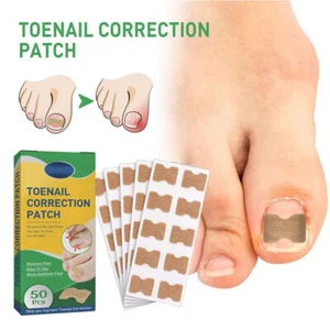 50pc Nail Correction Stickers Toenail Corrector Patches Waterproof Paronychia . - Picture 1 of 12