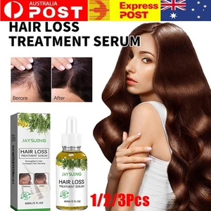 Anti Hair Loss Growth Treatment Regrow Dry Scalp Kit Pure Rosemary Essential Oil - Picture 1 of 15