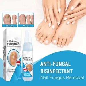 Nail Care Spray Nourishes The Skin And Nails, Improves Appearance And Odor,100ml - Picture 1 of 8