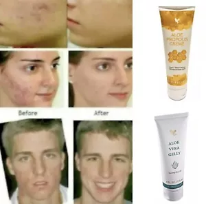 1 Forever Crema di Aloe PROPOLI 4 fl. oz. & 1 GELLY DI ALOE VERA 4 fl. oz. Exp. 2028 - Foto 1 di 5