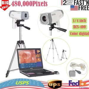 Carejoy 800K pixels Digital Electronic Colposcopy  Image Vaginal Camera - Picture 1 of 17