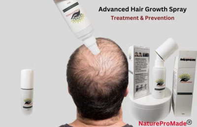 Advanced Hair Growth Spray (NaturePromade). Very Effective Ingredients! ON SALE - Image 1 of 4