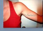 FOUND COLOR PHOTO O+9787 VIEW OF BRUISE ON WOMANS ARM