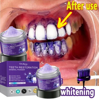Dental Restoration Mineral Powder, Mineral Tooth Powder, Teeth Whitening-HOT - Image 1 of 4