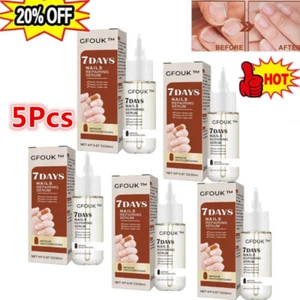 GFOUK 7 Days Nail Growth and Strengthening Serum& - Picture 1 of 14