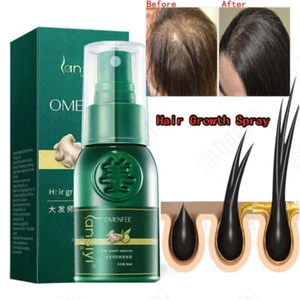 Fast Hair Growth Ginger Serum Spray Loss Treatment Natural Essence for Men Women - Picture 1 of 11