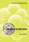 In Vitro Fertilization by Elder, Kay, Dale, Brian