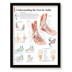 Understanding The Foot and Ankle Medical Educational, Poster 22x28 Wall Diagram - Imagen 1 de 5