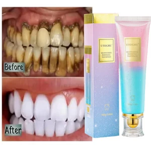 Niacinamide Whitening Toothpaste Niacinamide Intensive Whitening Toothpaste 100g - Picture 1 of 22
