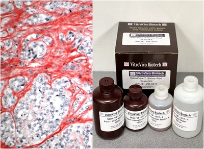 Kit de manchas rojas VitroView™ Picro-Sirius (Cat# VB-3017) Foto 1 de 4