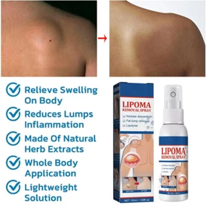 Lipomheilung Reduction Spray, Instant LumpFree Lipoma Removal Spray US - Picture 1 of 19