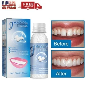 Temporary Tooth Repair Moldable Fix Broke Gap Teeth False Teeth Solid Glue - Picture 1 of 12