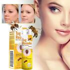 2024 New Tag Recede Bee Wart Treatment Spary, Bee Wart Removal Care Spray