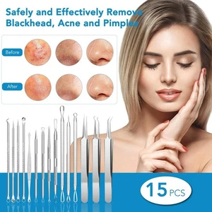 Acne Needle Blackhead Remover Pimple Blemish Comedone Extractor Tweezer Tool Kit - Picture 1 of 7