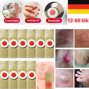 NEU Fußpflege Hühneraugen Pflaster Hühneraugenentfernung Warzenpflaster Patch DE - Picture 1 of 18