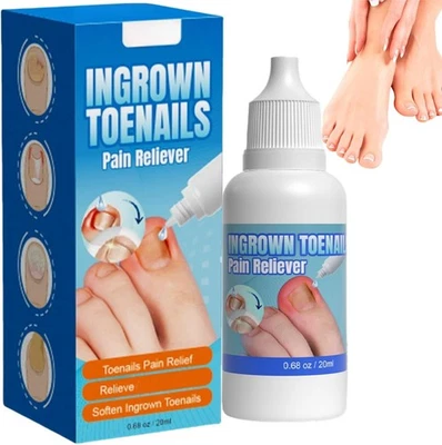 SALROAL Ingrown Toenail Treatment,Ingrowing Toenail Drop,Nail Treatment Fast Delivery UK