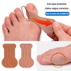 10Pcs Self-adhesive Big Toe Corrector Anti-wear Foot Corrector Stickers