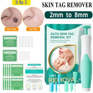 2in1 Painless Skin Tag Mole Wart Removal Kit Auto SKIN TAG Bands Remover Natural - Picture 1 of 18