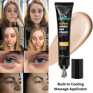 Under Eye Cream for Dark Circles, Puffy Eyes, Wrinkles & Removal 15gm - Picture 1 of 9