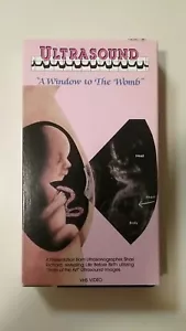 Ultraschall ""Ein Fenster in den Mutterleib"" - Shari Richard - 1991 - VHS - Bild 1 von 3