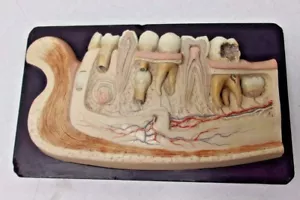 BOCK STEGER LABIOS MODELO DE YESO ANATÓMICO AYUDA DE ENSEÑANZA DENTAL ANTIGUA DE COLECCIÓN - Imagen 1 de 9