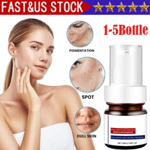 1-5PCWhiting And Freckle Removing Serum Cream Dark Spot Removing Freckle Essence - Picture 1 of 21