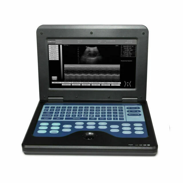 CONTEC CMS600P2 Portable Digital Ultrasound Scanner Machine