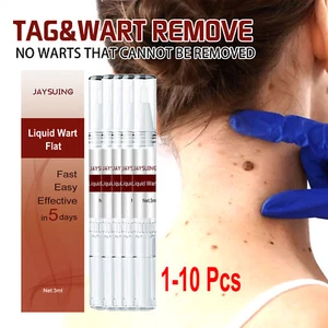Common and Plantar Moles-Off Wartsoff Remover, WipeOff Tags&Moles Remover US - Picture 1 of 17