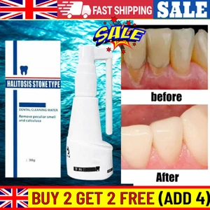 Dental Calculus Dissolving Spray Tartar Remover Teeth Cleaner Mouth Teeth Care` - Picture 1 of 7