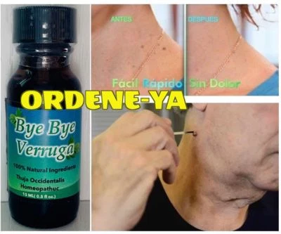 Etiqueta removedora de verrugas Bye Bye Verruga Sani Skin Out Verrugas  Foto 1 de 3