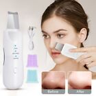 Cleaner Tool Face Cleaning Machine Facial Pore Cleaner Facial Skin Scrubber