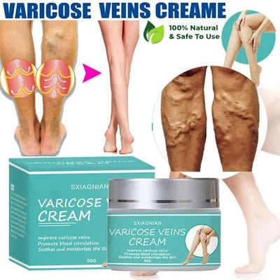 SXIAGNIAN Varicose Veins Treatment Cream Vasculitis Phlebitis Spider Relief Pain Ointment