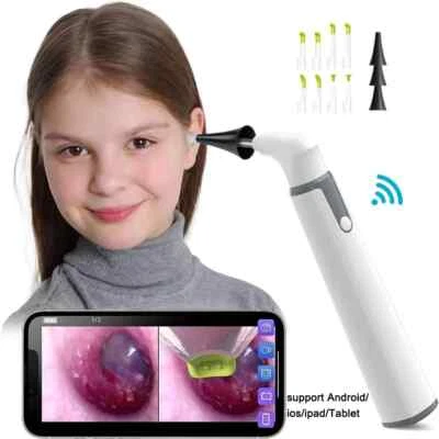 1080P Wireless Otoscope Ear Camera 3.9mm WiFi Endoscope LED Scope Kids Adults - Image 1 of 4