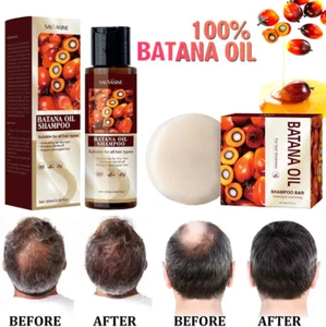 BATANA OIL Shampoo Hair Growth Pure & Natural - Promotes Hair Regrowth Hair Care - Picture 1 of 31