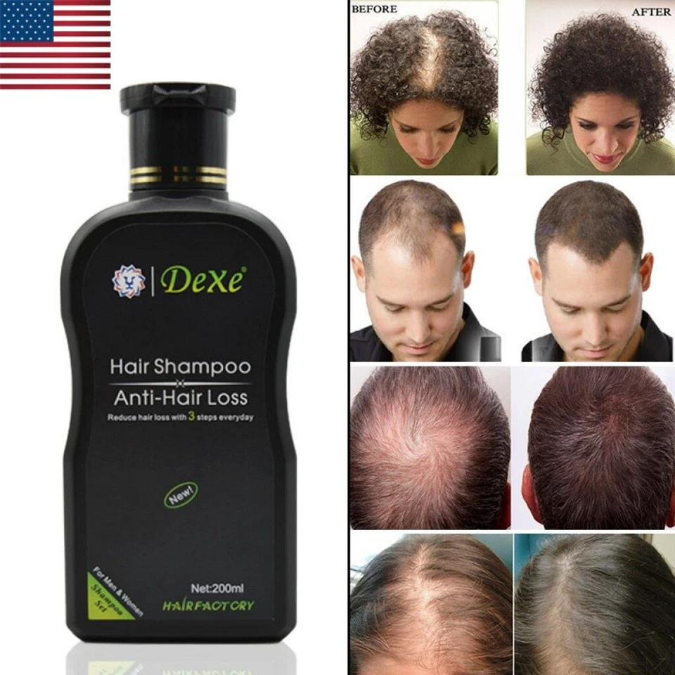 DEXE Hair Growth Shampoo Hair Regrowth Anti-Hair Loss Shampoo For Men and Women