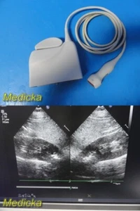 Philips S5-1 Teile-Nr. 21314A Sector Array Ultraschallsonde Ref 453561176747 ~ 36784 - Bild 1 von 24