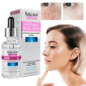 Kojic Acid Face Serum Strong Brightening Face Serum Fade Dark Spot Sunburns 30ml - Picture 1 of 6