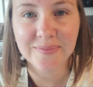 STERILIZE PACK: TINIEST 2mm Balls 16g 8mm dia. Surgical Steel Septum Horseshoe. - Picture 1 of 8