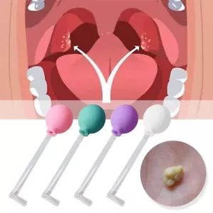 Tonsil Stone Remove Tool Manual Style Cleaner Removal Cleaning Mouth Care - Picture 1 of 10