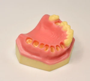 Implante Dental Inmediato Mandíbula Superior Dientes Perforación Lluvia Odontología Educación - Imagen 1 de 10