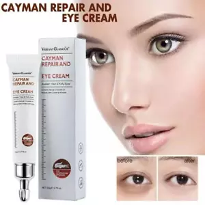 Cayman Eye Cream Instant Eye Bags Dark Circles Removal Puffiness Anti U0X1 - Picture 1 of 15