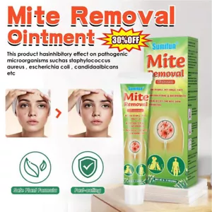 Mite Removal Ointments Anti Itching Scabies Kill Head Lice Treatment Care Crea✨ - Picture 1 of 10