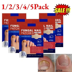 1/2/3/4/5PACK Nail Fungus Repair Plasters, Fungus Treat ment, Nail Repair - Picture 1 of 16