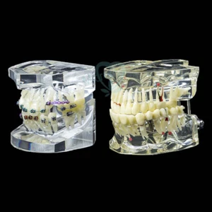 1Pc Dental Orthodontic Study Teach Teeth Model with Metal Brackets Brace - Picture 1 of 23