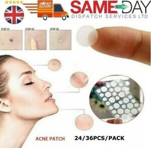24PCS Acne Patch Tag Hydrocolloid Pimple Scar Spot Skin Tag Remover Plaster UK