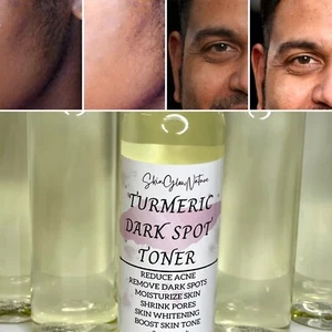 Turmeric Dark Spot Toner/LighteningEXP .Date 08/01/2025 - Picture 1 of 5