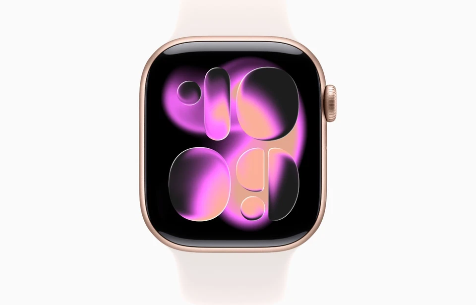 Apple Watch Series 11 (2025) GPS 42mm Cassa Oro Rosa Cinturino Fard S/M MEU04 - Immagine 1 di 4